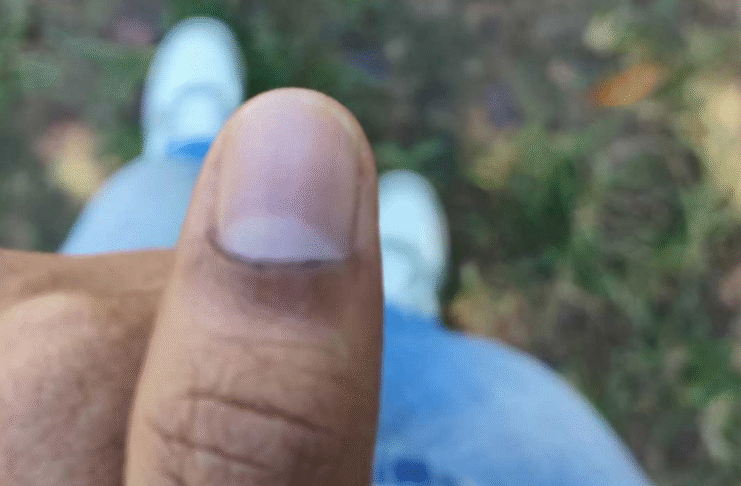 চাকসু নির্বাচন